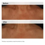 Niacinamide 5% Face and Body Emulsion - Image 2